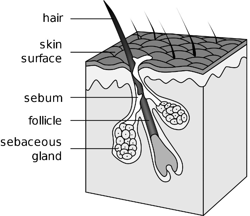 How to Get Rid of Baby Dandruff - Sebaceous Gland