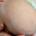Newborn Baby Dandruff or Cradle Cap